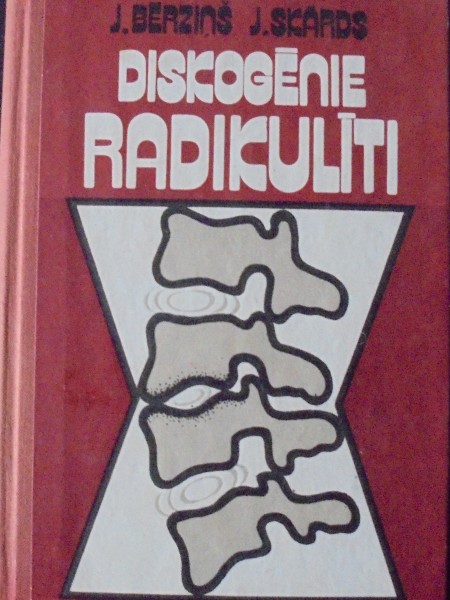 Diskogēnie radikulīti