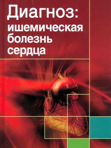 Диагноз. Ишемическая болезнь сердца